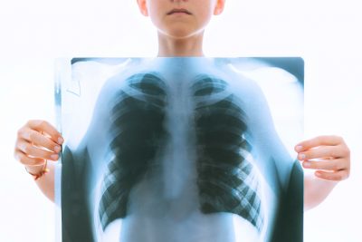在COVID-19大流行期间，一个孩子拿着x光片显示肺部