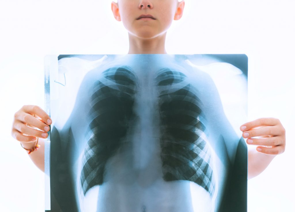 在COVID-19大流行期间，一个孩子拿着x光片显示肺部